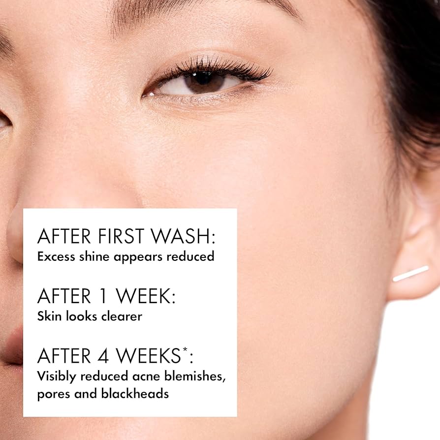 Vichy Normaderm Phytosolution Face Cleanser Gel for Oily/Acne Skin with Salicylic Acid