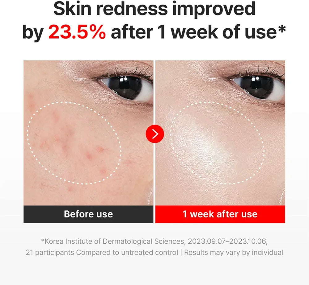 Centellian24 Madeca Cream Time Reverse