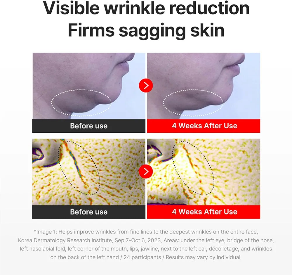 Centellian24 Madeca Cream Time Reverse