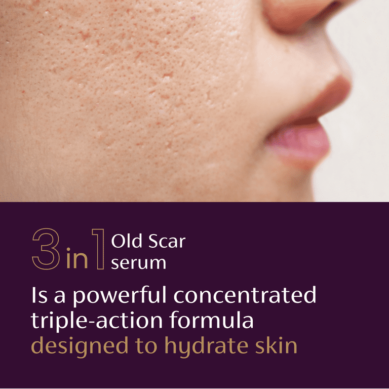 Mederma Scar Serum (30ML)