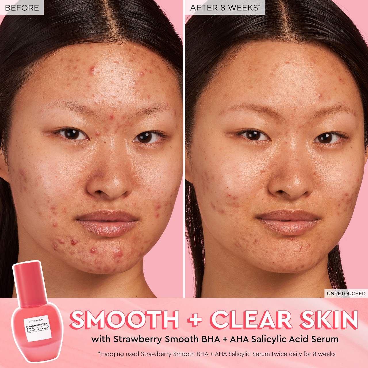 GLOW RECIPE Strawberry Smooth BHA+AHA Salicylic Serum,30ml