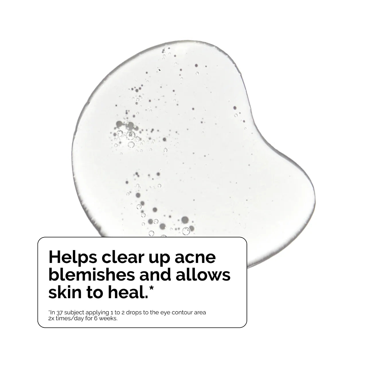 The Ordinary Salicylic Acid 2% Exfoliating Blemish Solution