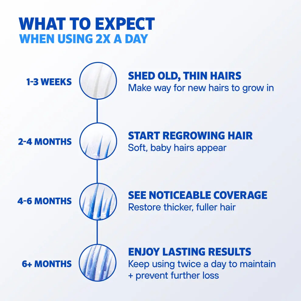 Men's ROGAINE® 5% Minoxidil Unscented Foam - 3-Month Supply