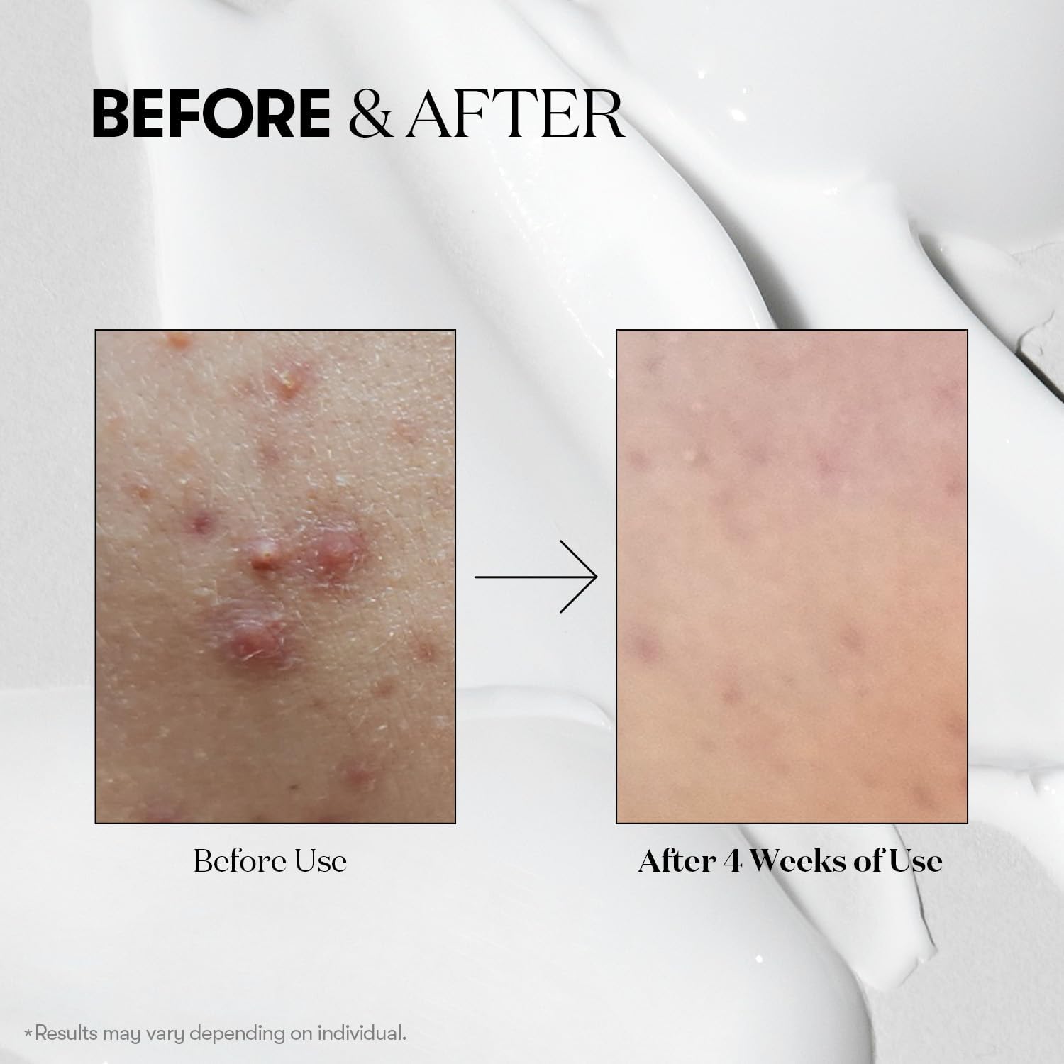 VT COSMETICS CICA Reedle Shot 100, Daily Night Exosome, Microneedling Serum