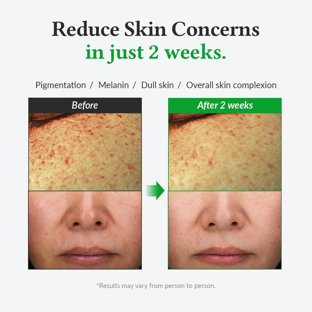 Dr.Althea Gentle Vitamin C Serum