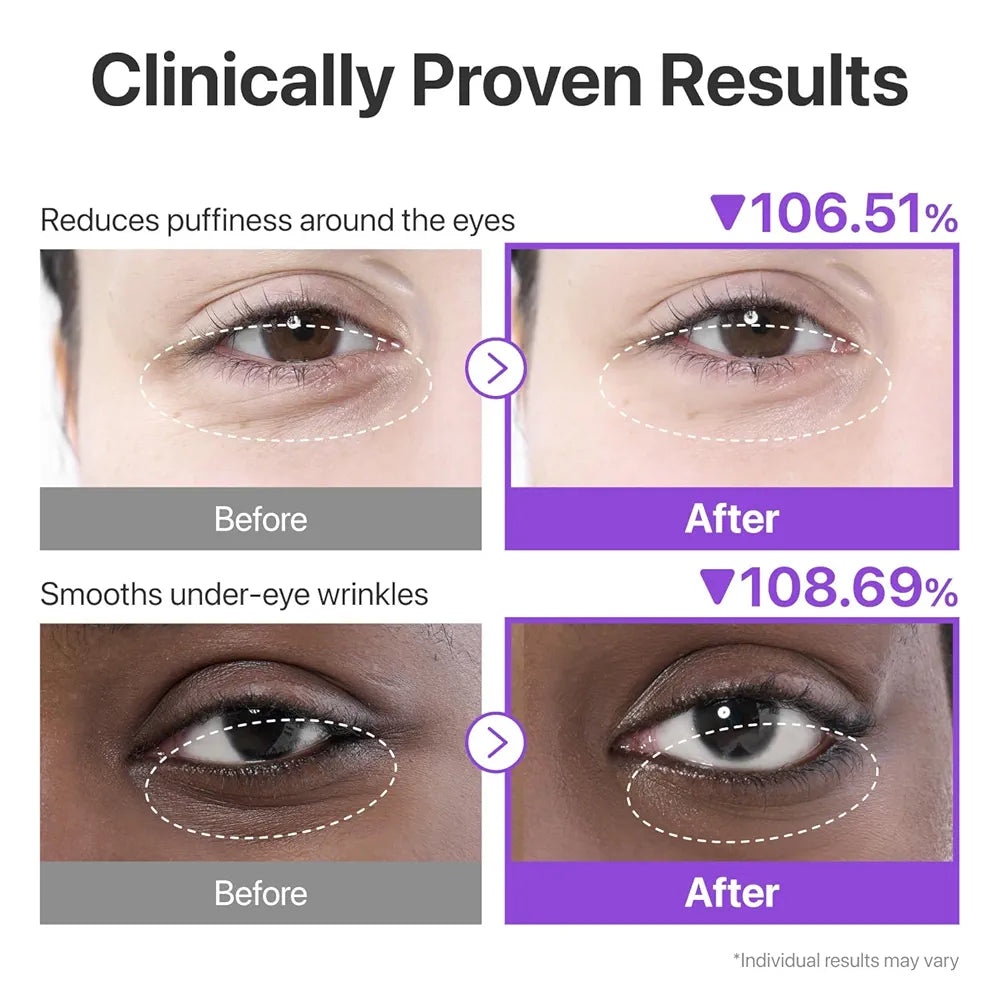 numbuzin No.9 Eye Patches | NAD+ Collagen Under Eye Patches