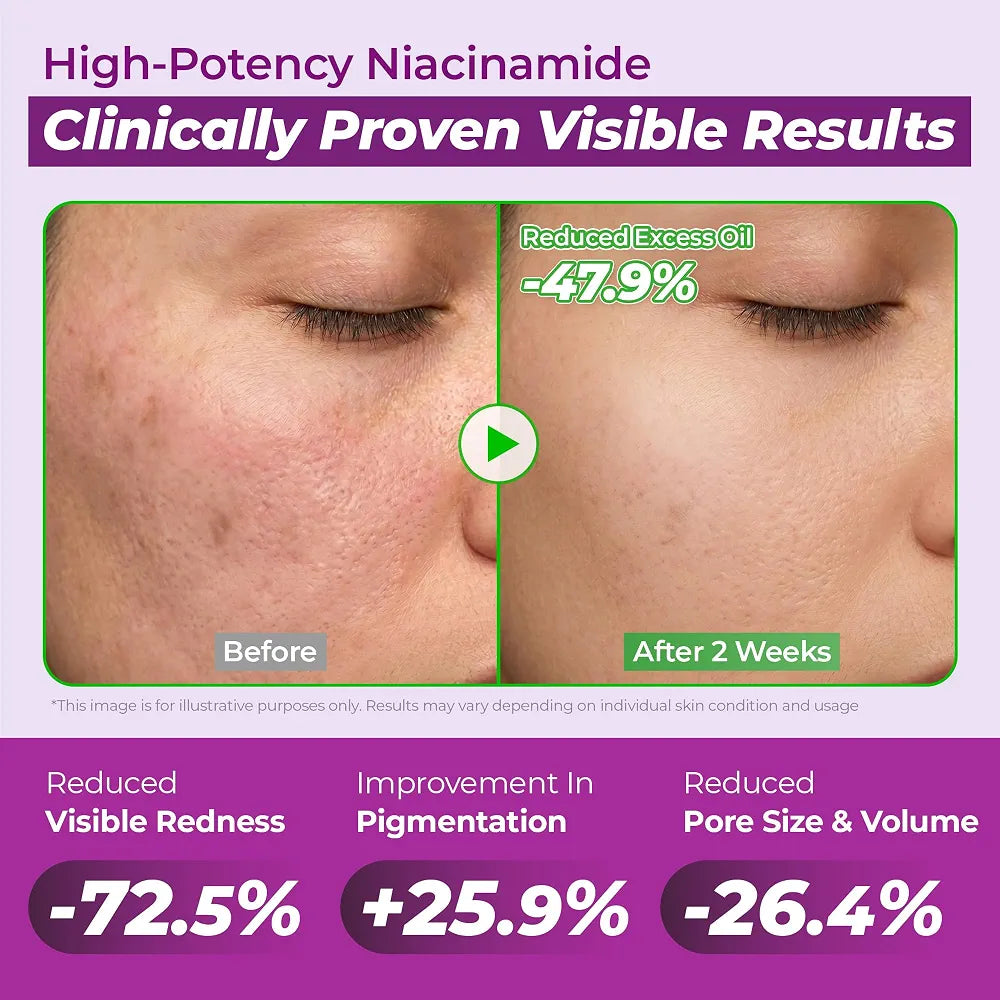 JUMISO 10% Niacinamide Dark Spot Serum for Uneven Tone