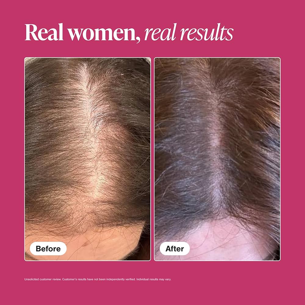 Viviscal Hair Growth Supplements for Women
