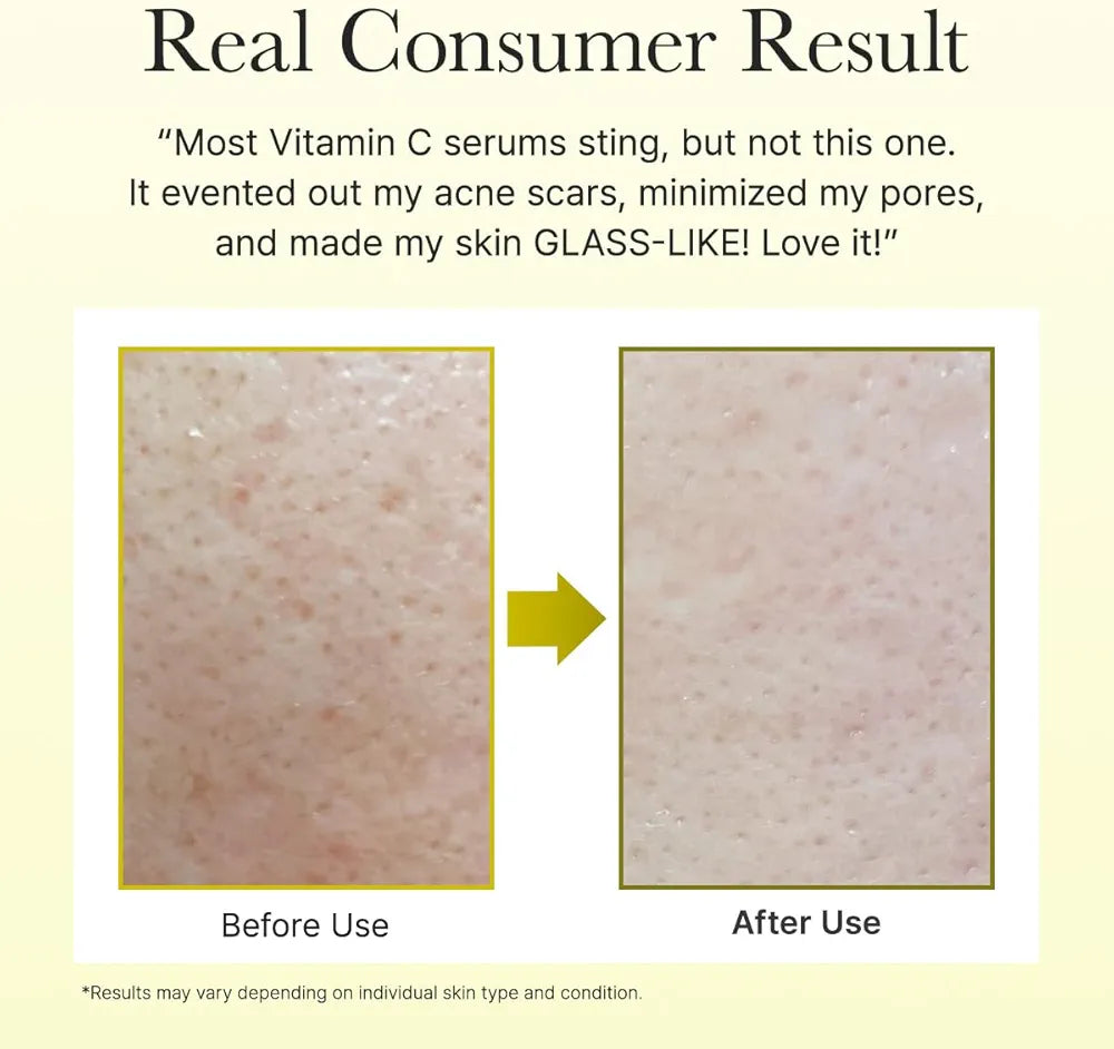 Arencia Vitamin C Booster Shot Serum with Glutathione, Niacinamide and Vitamin E