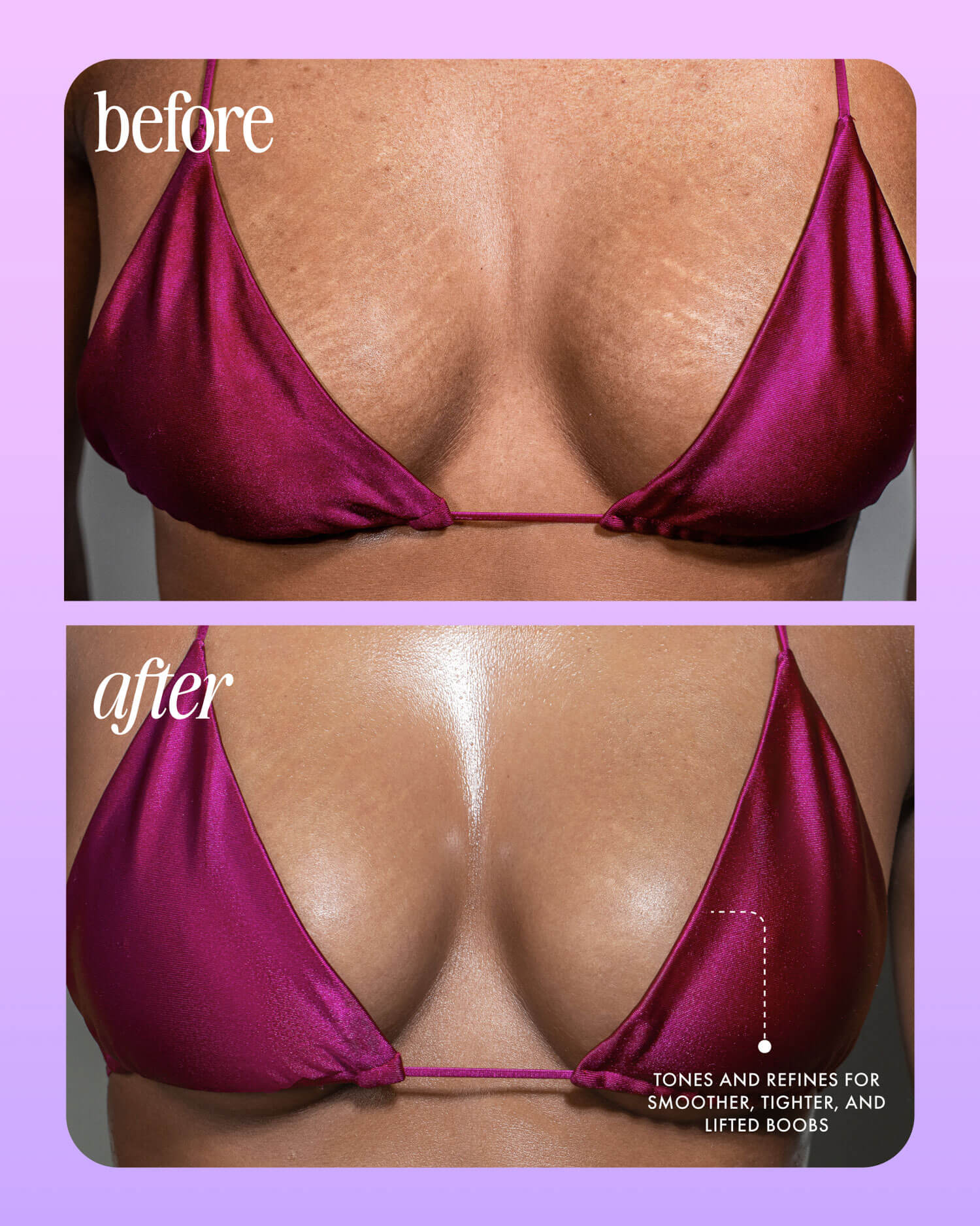 Truly Acai Your Boobies Serum