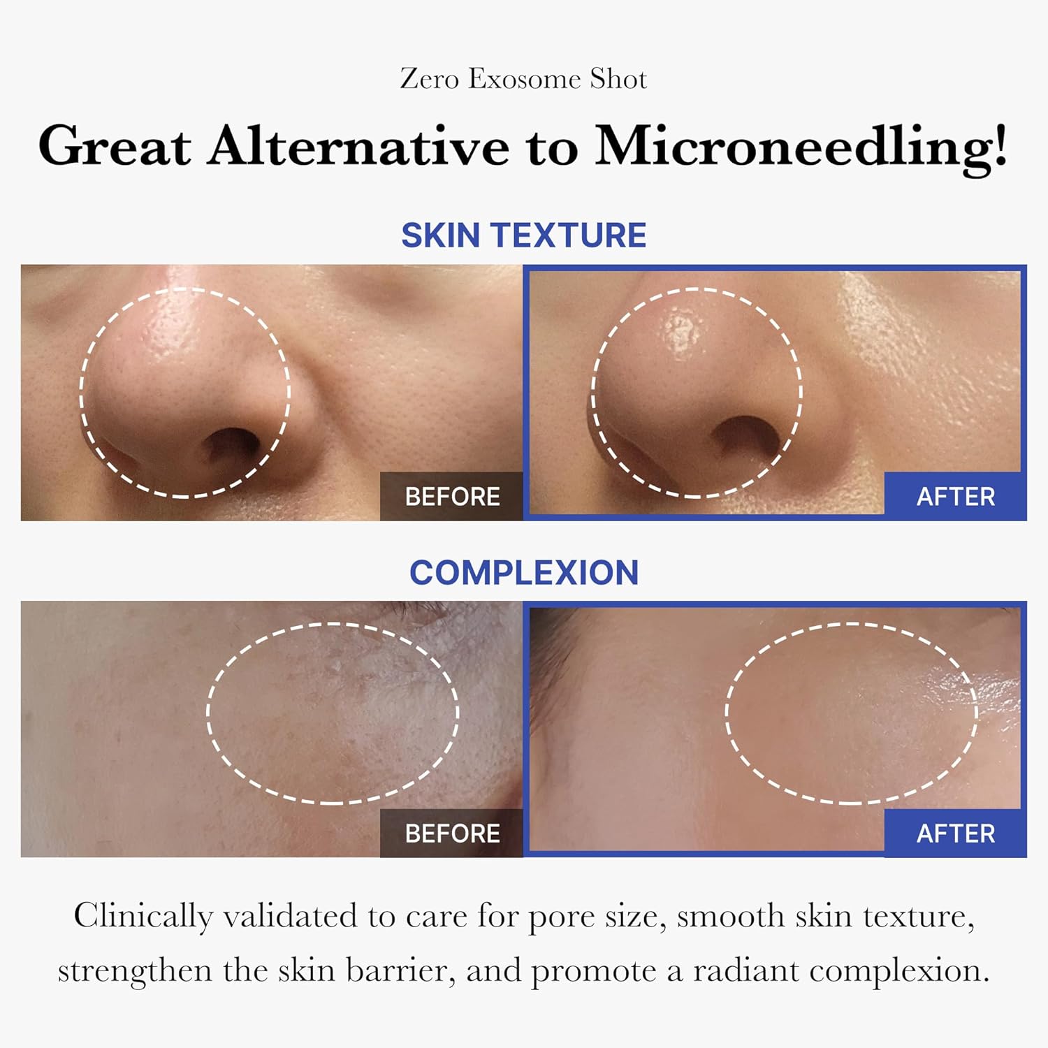 Medicube Zero Exosome Shot 2,000 PPM Spicule Facial Serum