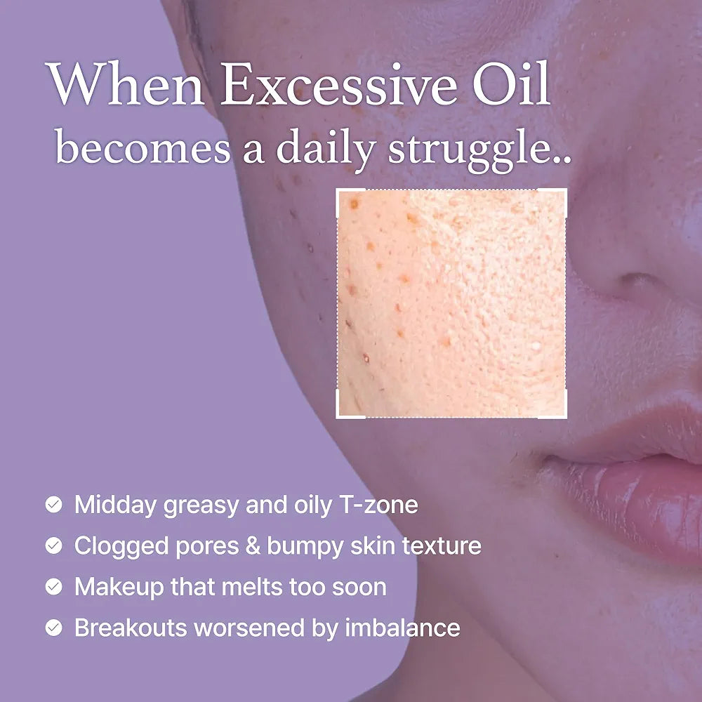 I'm from Black Rice Toner for Oily Skin, Sebum Control Toner