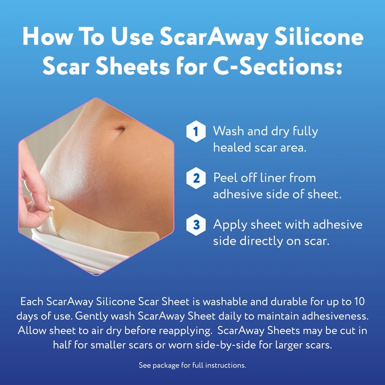 ScarAway Medical-Grade Silicone Scar Sheets – C-Section Scar Care (4 Sheets)