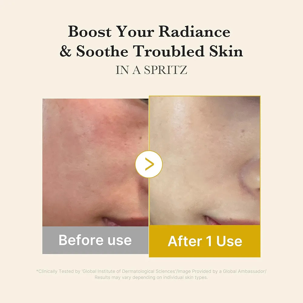 Medicube Jelly Mist Serum with Kojic Acid Turmeric | 2-in-1 Daily Facial Spray and Serum