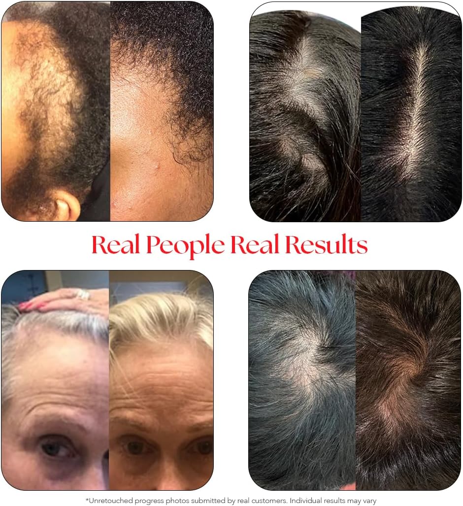 HAIRtamin Scalp Serum Natural Hair Growth Thickening Treatment