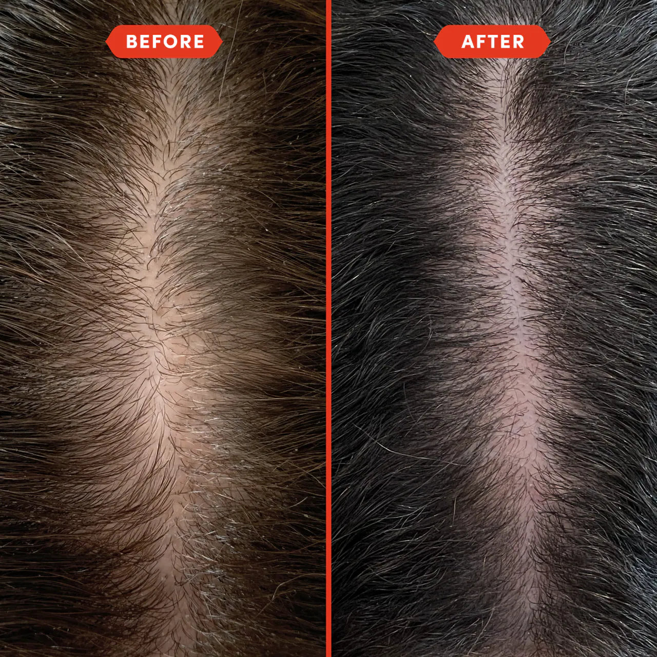 Fable & Mane 
HoliRoots™ Pre-Wash Treatment Oil for Thinning Hair