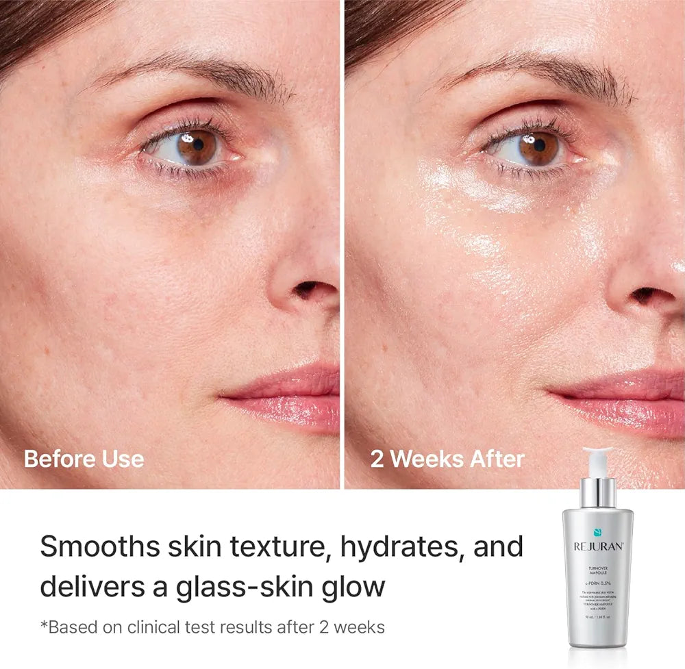 Rejuran Turnover Ampoule c-PDRN® 0.5% Renewing Serum for Smooth Texture & Glass Skin