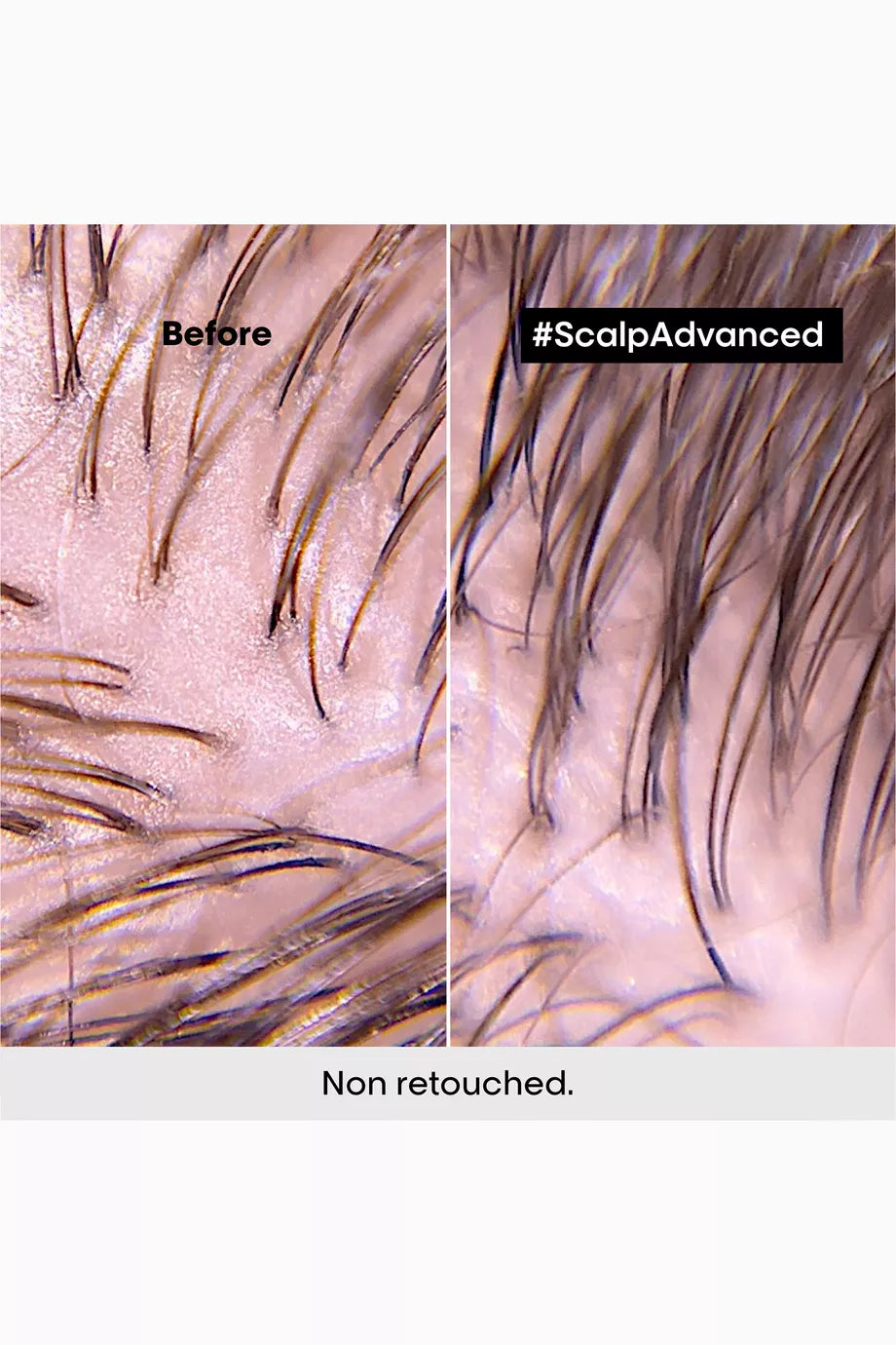 L'Oreal Professionnel Scalp Advanced Anti Oiliness Shampoo for Oily Scalp